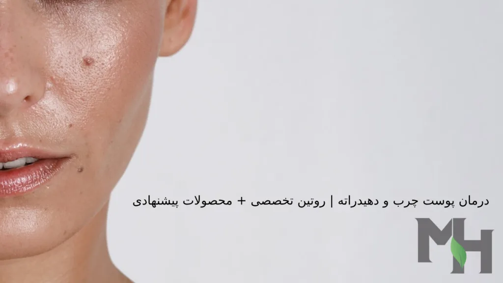 درمان پوست چرب و دهیدراته | روتین تخصصی + محصولات پیشنهادی