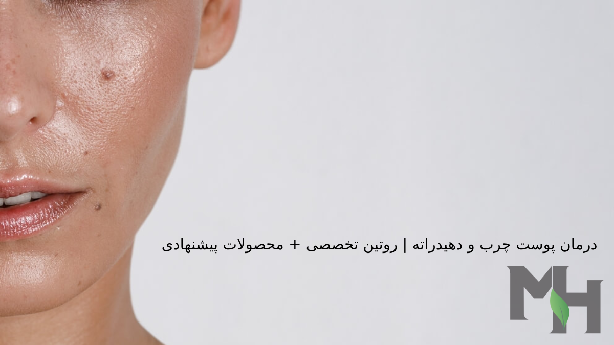 درمان پوست چرب و دهیدراته | روتین تخصصی + محصولات پیشنهادی